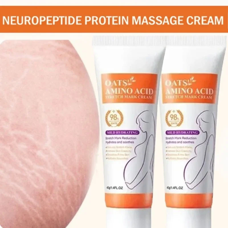 Cream For Pregnancy Stretch Marks Removal Eliminate Red White Old Stretch Marks  2025